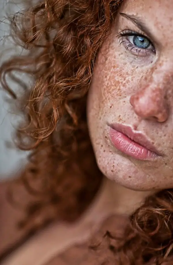 Fascinating Pictures Of People With Freckles Greenorc